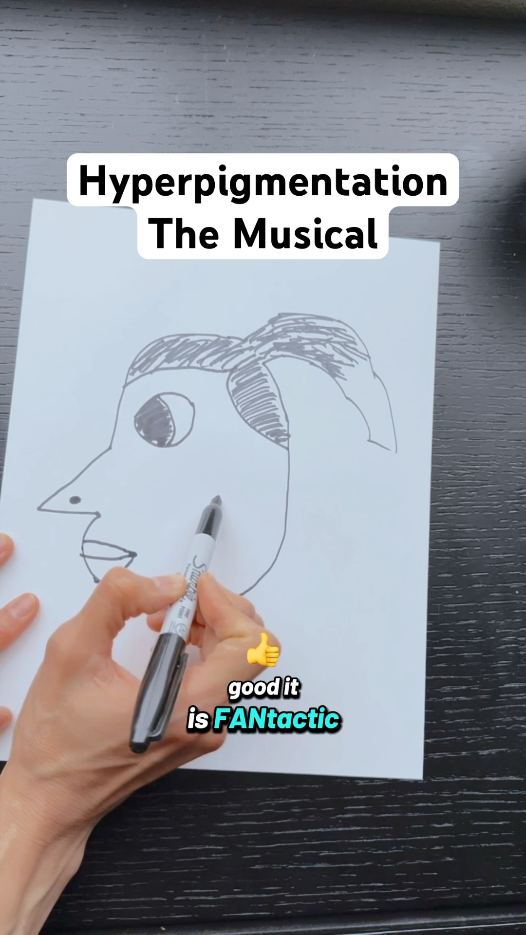 Hyperpigmentation: The Musical #TheManniiShow.com/series