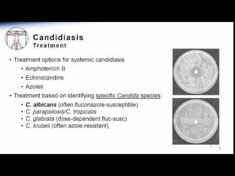 Candida: Systemic Candidiasis Treatment & Prevention