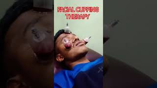 Facial Cupping Therapy For Pimples Treatment skincare youtubeshorts