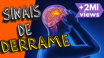 Quais os primeiros sinais do AVC?