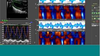 Webinar: Cardiovascular Analysis Q&A Forum - VisualSonics screenshot 5