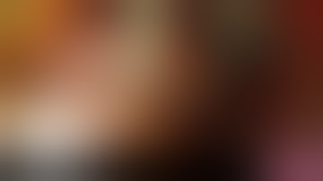 4 part proximal humerus fracture: open reduction and internal fixation