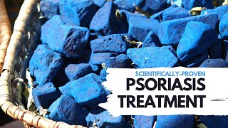 Discover the Scientifically-Proven Psoriasis and Eczema Treatment - Earth Clinic