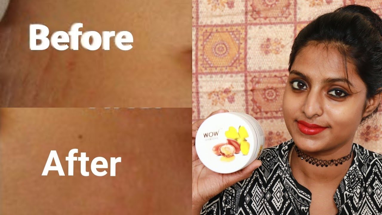 wow stretch marks & scar lightening cream