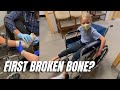 Eight year old has a bad tumbling accident  possible first broken bone