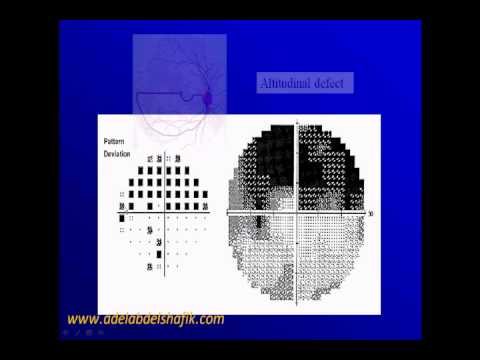 Hoe te veldrapport Humphery lezen? part 7.wmv