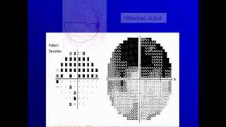 How to read Humphery's  field report  part 7.wmv