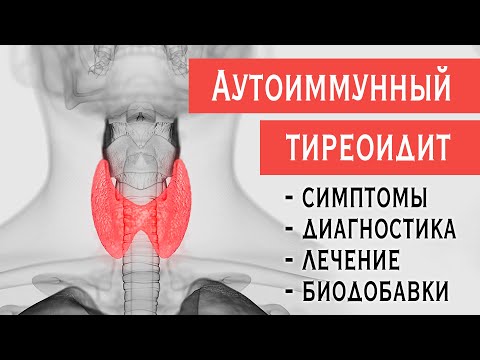 Аутоиммунный тиреоидит (АИТ, зоб Хашимото): симптомы гипотиреоза, диагностика, лечение, биодобавки.