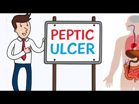 PEPTIC ULCER DISEASE - CAUSES AND TREATMENT!