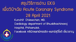 สรุปวิธีอ่าน EKG เพื่อวินิจฉัย Acute Coronary Syndrome