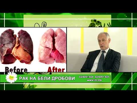 Фактор здравје - Рак на бели дробови