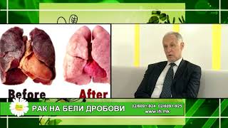 картинка: Фактор здравје - Рак на бели дробови
