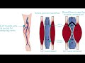 Soleus Muscle | Trigger Point Anatomy | Referred Pain