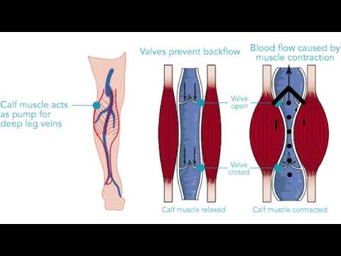 Soleus Muscle | Trigger Point Anatomy | Referred Pain