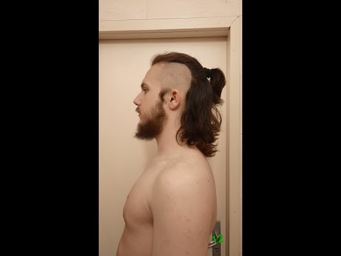 hair growth time lapse 1 year (mohawk)🤘🏻