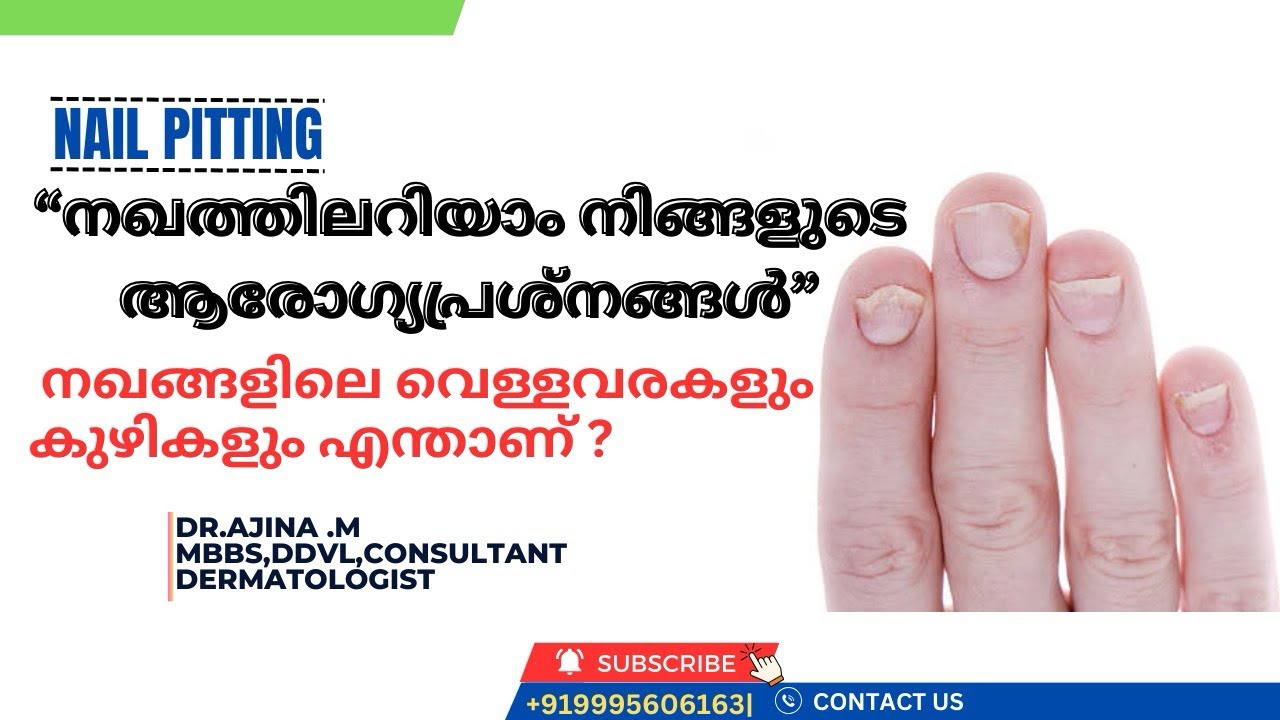 നിപയില്‍ വീണ്ടും ആശ്വാസം: ഹൈറിസ്‌ക് സമ്പര്‍ക്കപ്പട്ടികയില്‍ 61 പേരുടെ ഫലം  നെഗറ്റീവ്