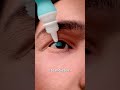 How contact lenses become stuck 