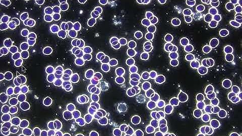Purported Before & After Healy Blood Sample