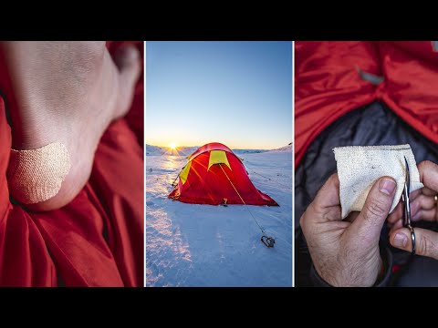 GNAGSÅR - Hvordan forebygge og behandle gnagsår på tur -  Ep 5 Kurs i friluftsliv