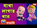 ব্যথা লাগার গান (The Boo Boo Song) - Bangla Rhymes For Children - ChuChu TV