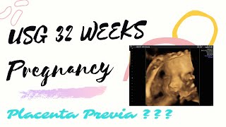 USG 32 WEEKS PREGNANCY // USG 32 MINGGU KEHAMILAN - Bahasa
