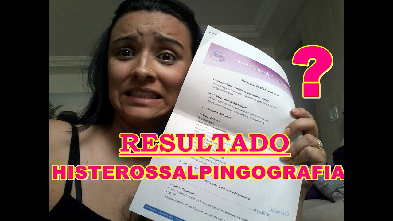 Resultado do exame histerossalpingografia