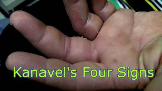 Kanavel's Four Cardinal Signs
