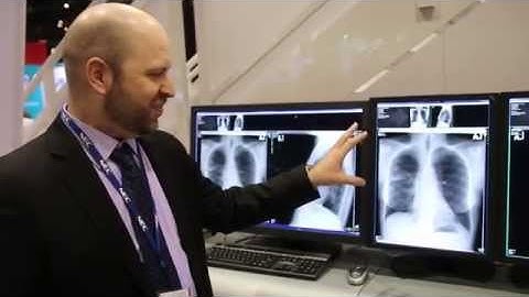 Medical Displays Tour at RSNA 2014 | NEC Display Solutions