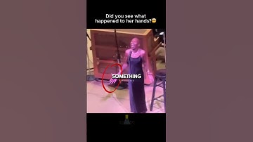 Watch Her Hands Closely 👀