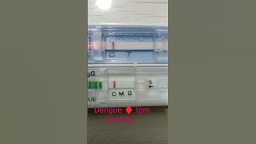 Pathology #lab technician  dengue card IGM positive #.   short video #YouTube video #viral