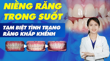 Niềng răng trong suốt - Tạm biệt tình trạng răng khấp khểnh | Nam Bùi Vinalign