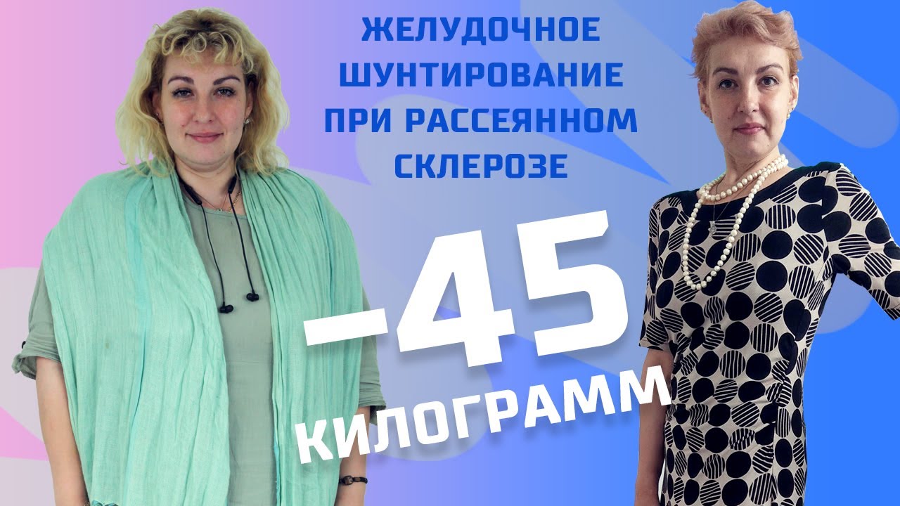 ЖЕЛУДОЧНОЕ ШУНТИРОВАНИЕ ПРИ РАССЕЯННОМ СКЛЕРОЗЕ - Интервью с пациентом ...