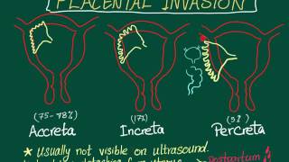 Placental Invasion Placenta Accreta Increta And Percreta Mnemonic
