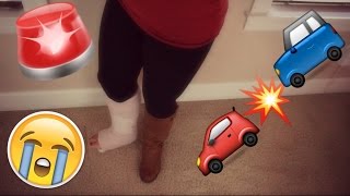 Car Accident Broke My Leg!!! Part 1 | Storytime