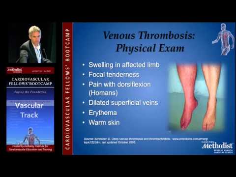 Diagnosis DVT and PE (David Rigberg, MD)