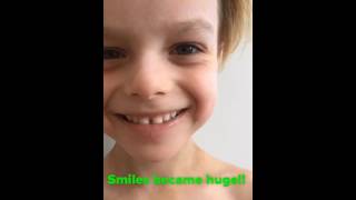 Экзема - как её лечили | Eczema - how it treated Экзема - как её лечили | Eczema - how it treated