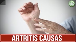 Dolor de el se siente artritis cómo