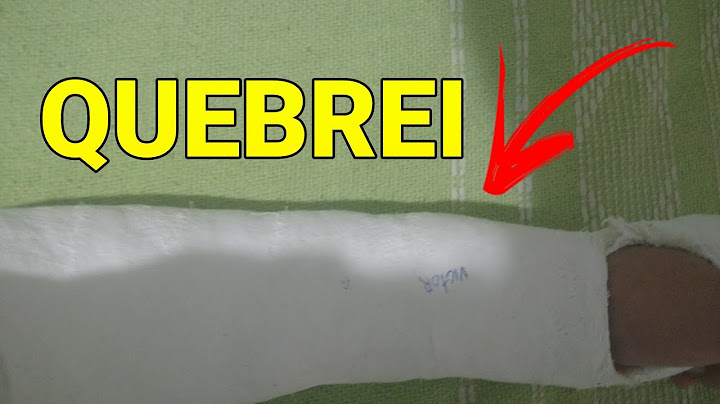 QUEBREI meu BRAÇO!! Vou postar vídeos??