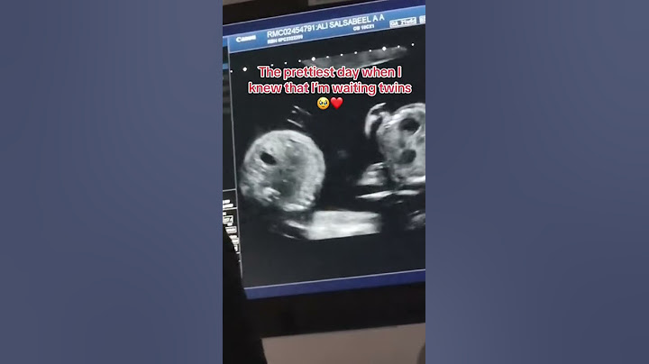 أجمل لحظة في حياتي وقت اخبرني الطبيب اني حامل بتوأم #baby