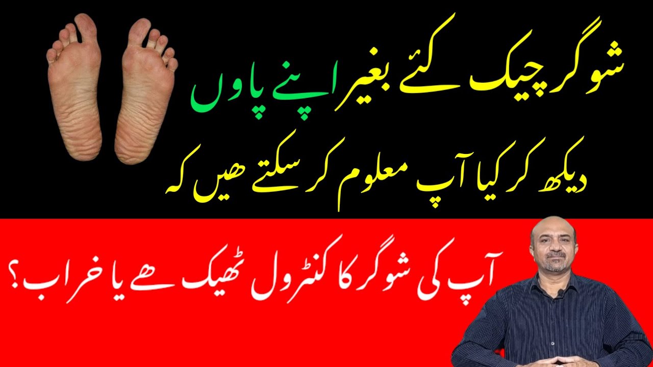 Signs Of Poor Blood Glucose Control In feet