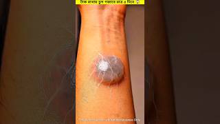 Tumor Treatment ~ New tools | Hand Made | Hand Crafts | Creative idea