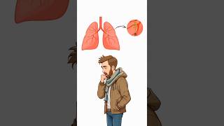 No One Expected What Was Inside His Lung! 🫁😱