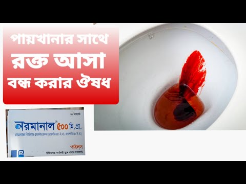 ভিডিও: কে ট্রনেক্স গ্লাভস তৈরি করে?