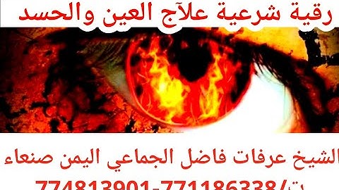 أفضل رقية شرعيه علآج العين والحسد الشيخ عرفات فاضل الجماعي راقي شرعي في اليمن في صنعاء 774813901