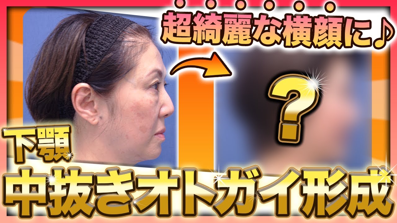 顎の整形・骨削りなら理想の美しいりんかくへのガーデンクリニック