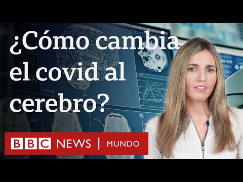 Video: ¿El covid afecta el cerebro de los niños?