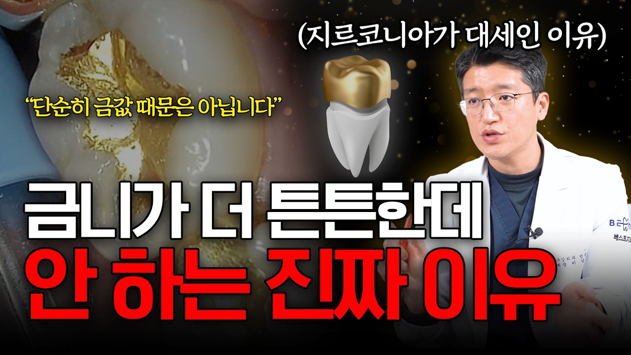 금니가 더 튼튼한데 왜 안 할까요? (치과의사가 말하는 진짜 이유)