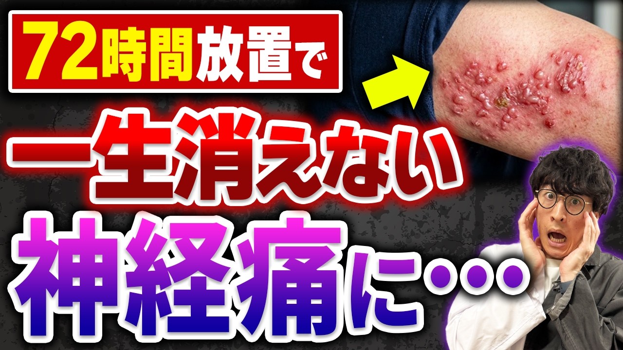 【帯状疱疹】その痛み、今すぐ動かないと神経が死にます。薬剤師が72時間以内にやるべきことを全部話します