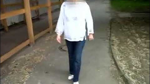 Marie   Functional Gait Disorder