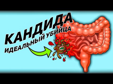 Видео: Где встречается Candida albicans?